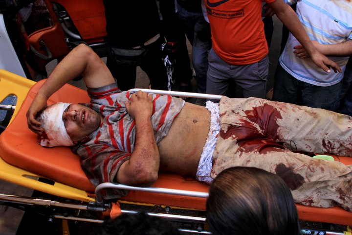 A man injured from clashes between supporters of Egyptian President Mohamed Mursi and anti-Mursi protesters lies on a stretcher in Sedy Gaber in Alexandria, June 28, 2013. 