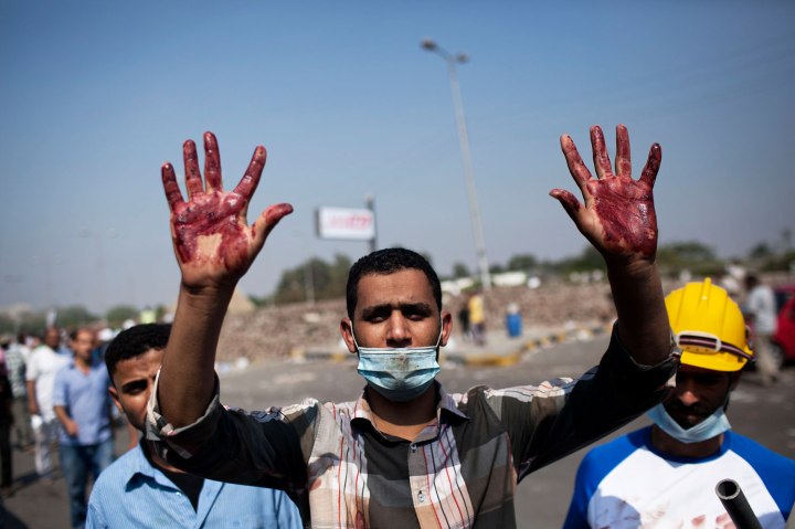 A supporter of Egypt's ousted President Mohammed Morsi shows his bloody hands after clashes with security forces at Nasr City, near where pro-Morsi protesters have held a weeks-long sit-in, in Cairo, Egypt, July 27, 2013. 