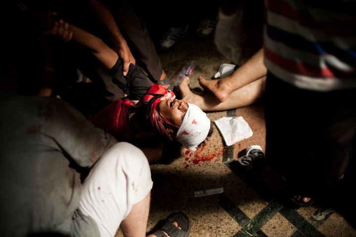 Doctors treat a supporter of Egypt's ousted President Mohammed Morsi who was injured during clashes with security forces in Nasr City, in a field hospital in Cairo, July 27, 2013. 