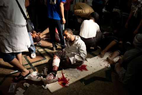 A wounded supporter of Egypt's ousted President Mohammed Morsi lies on the floor of a field hospital in Nasr City, Egypt, July 27, 2013. 