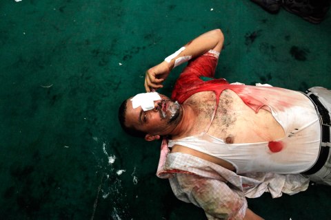 An injured protesters who supports ousted Egyptian President Mohamed Mursi lies inside a  mosque in Ramses Square in Cairo